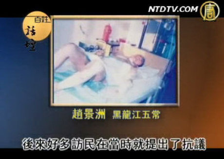 【百姓話壇】自焚