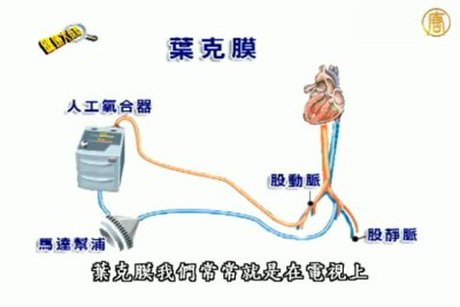 健康大哉問:心臟也會感冒