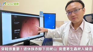 美洲鉤蟲與十二指腸鉤蟲,可經由皮膚穿透造成傳染,並在體內產卵滋長,醫師呼籲,民眾到野外務必穿鞋,降低鉤蟲入侵體內的風險。(圖/亞洲大學附屬醫院提供)