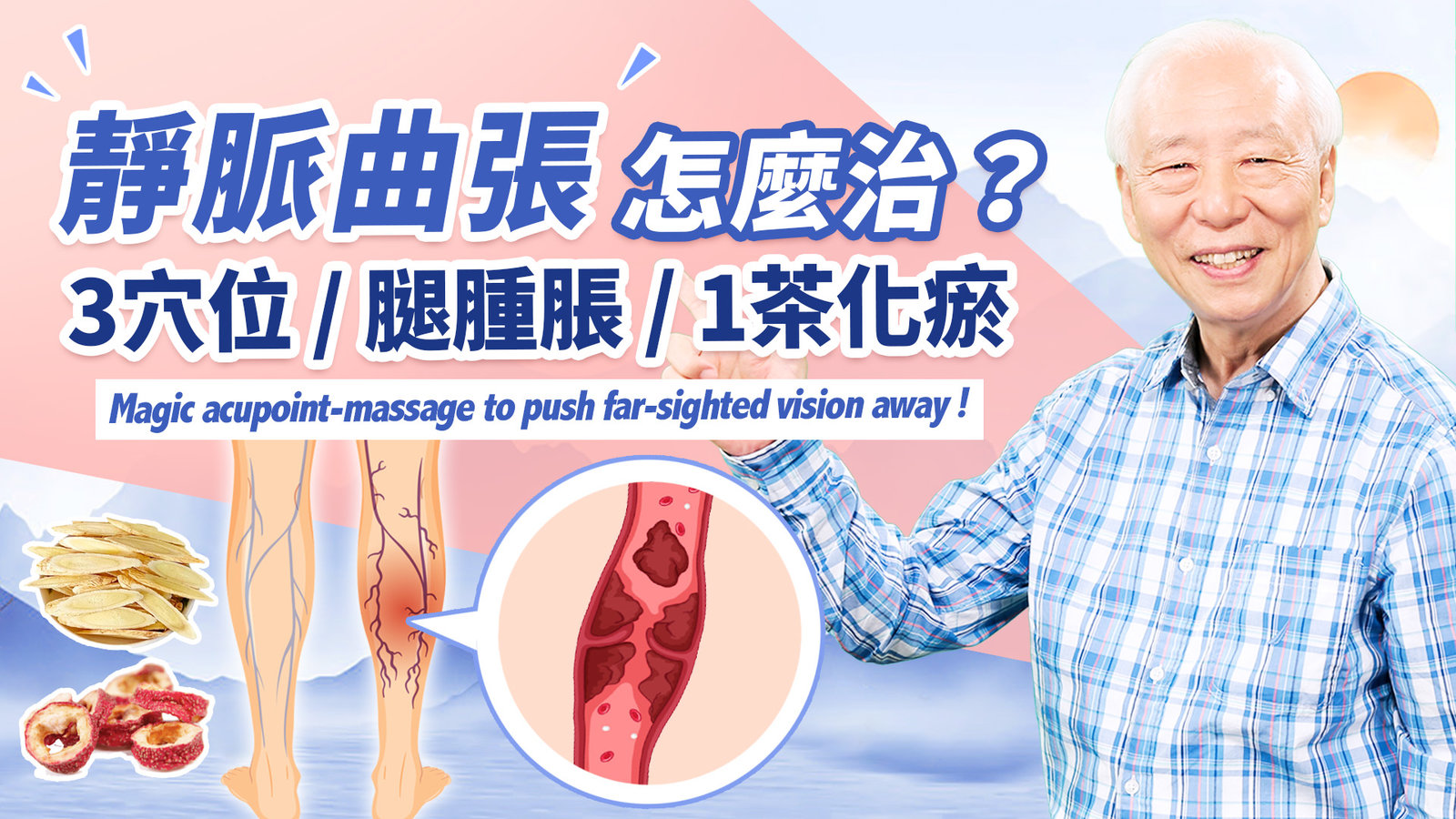 恢復腿部健康!3穴位,改善腿腫脹、浮腳筋。1動作+1茶飲,讓下肢血液循環通暢。這1種靜脈曲張需治療。小心!穿壓力襪造成缺血。 中醫放血療法,有效治靜脈曲張|胡乃文開講Dr.HU_199