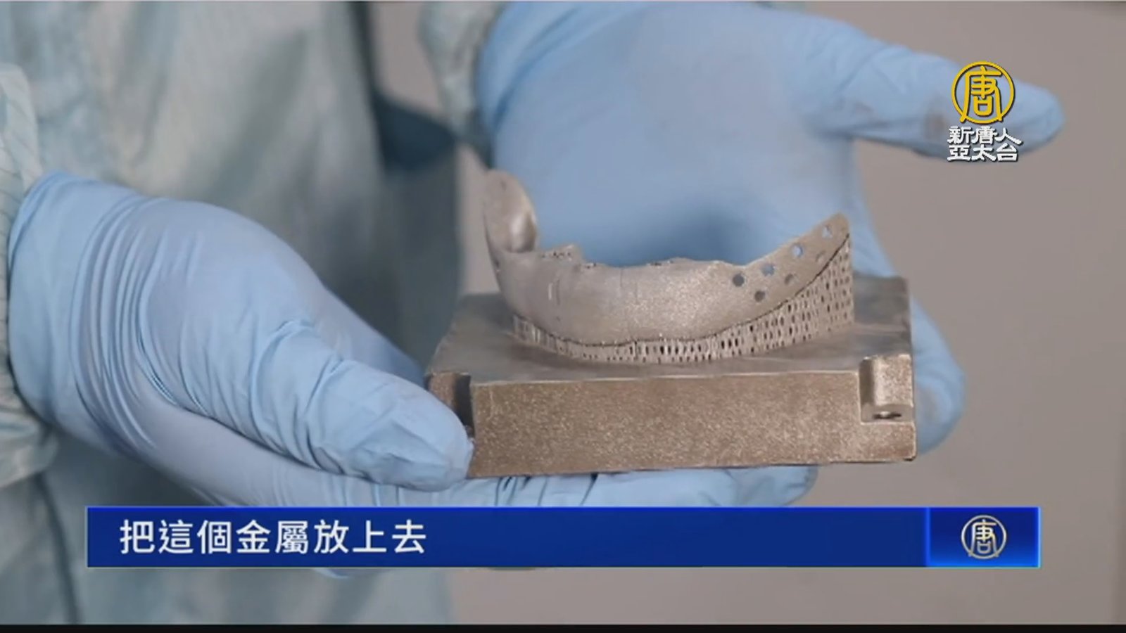 工研院攜高榮 3D列印口顎彌補物助口腔癌重建