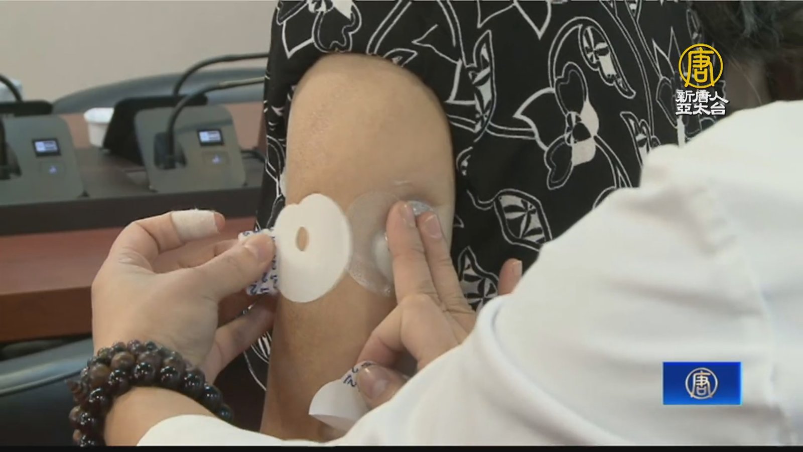 連續性血糖監測感應貼片 糖友管理血糖有技巧