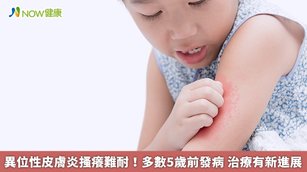 異位性皮膚炎搔癢難耐!多數5歲前發病 治療有新進展(首圖來源/Freepik)