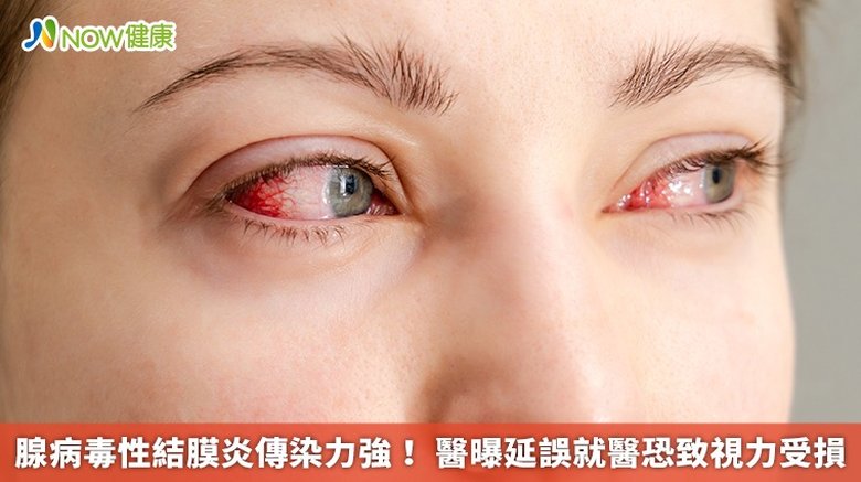 腺病毒性結膜炎傳染力強!醫曝延誤就醫恐致視力受損(首圖來源/Freepik)