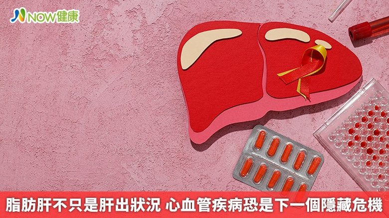 脂肪肝不只是肝出狀況 心血管疾病恐是下一個隱藏危機(首圖來源/Freepik)