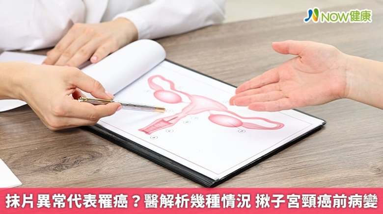 抹片異常代表罹癌?醫解析幾種情況 揪子宮頸癌前病變(首圖來源/Freepik)