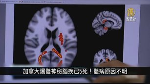 加拿大爆發神秘腦疾已5死！發病原因不明｜寰宇掃描