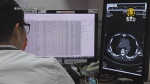 食道癌不易早期發現 把握黃金治療期是關鍵