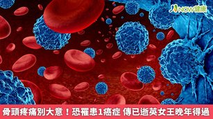 在症狀方面，約2成患者在確診罹骨髓瘤時完全無症狀，其他患者則症狀不一，以骨頭疼痛最為常見。（圖／NOW健康製作；圖片來源／ingimage）