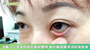 登革熱疫情升溫近期各界都需要驅蟲消毒，但有名婦人某天使用噴霧器噴灑消毒劑時，不慎將藥水噴濺到眼睛，立刻感到劇痛難忍，視力模糊、淚水直流。（圖／彰基提供）