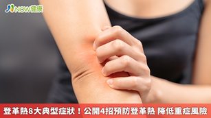 登革熱被列為第2類傳染病，其傳染途徑主要是因帶有登革病毒的埃及斑蚊、白線斑蚊，叮咬人體後，將病毒傳播給人類所致，而感染登革熱後最為明顯的症狀為皮膚紅疹，還可能出現頭痛、發高燒、關節痛等症狀。（圖／NOW健康製作；圖片來源／ingimage）