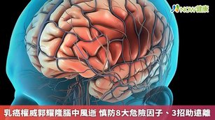 腦中風嚴重威脅國人健康，衛福部統計，平均每45分鐘就有1人死於腦中風。（圖／NOW健康製作；圖片來源／ingimage）