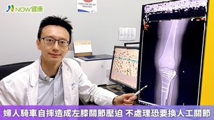 長安醫院骨科醫師洪舜奕表示，民眾若膝蓋受傷後，有長期疼痛、彎曲角度受限、跛行等情形，應提高警覺，及早尋求專業骨科醫師的協助。（圖／長安醫院提供）
