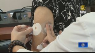 連續性血糖監測感應貼片 糖友管理血糖有技巧