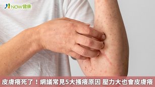 皮膚癢死了！網議常見5大搔癢原因 壓力大也會皮膚癢(首圖來源／Freepik)