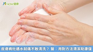 皮膚病灶遇水就痛不敢清洗？醫：用對方法清潔助康復(首圖來源／Freepik)