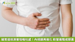 腸胃道檢測害怕嘔吐感！內視鏡再進化 軟管進階成膠囊(首圖來源／Freepik)