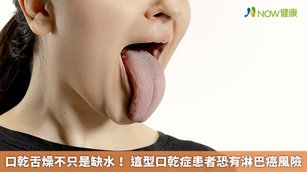 口乾舌燥不只是缺水！ 這型口乾症患者恐有淋巴癌風險(首圖來源／Freepik)