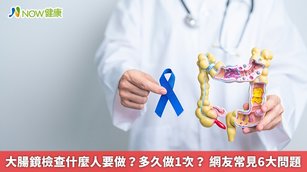 大腸鏡檢查什麼人要做？多久做1次？ 網友常見6大問題(首圖來源／Freepik)