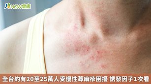 全台約有20至25萬人受慢性蕁麻疹困擾 誘發因子1次看(首圖來源／Freepik)