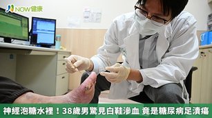 神經泡糖水裡！38歲男驚見白鞋滲血 竟是糖尿病足潰瘍(首圖來源／亞洲大學附屬醫院提供)