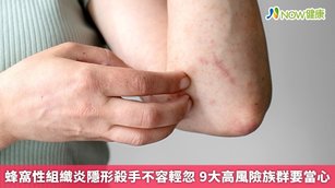 蜂窩性組織炎隱形殺手不容輕忽 9大高風險族群要當心(首圖來源／Freepik)